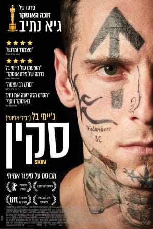 סקין